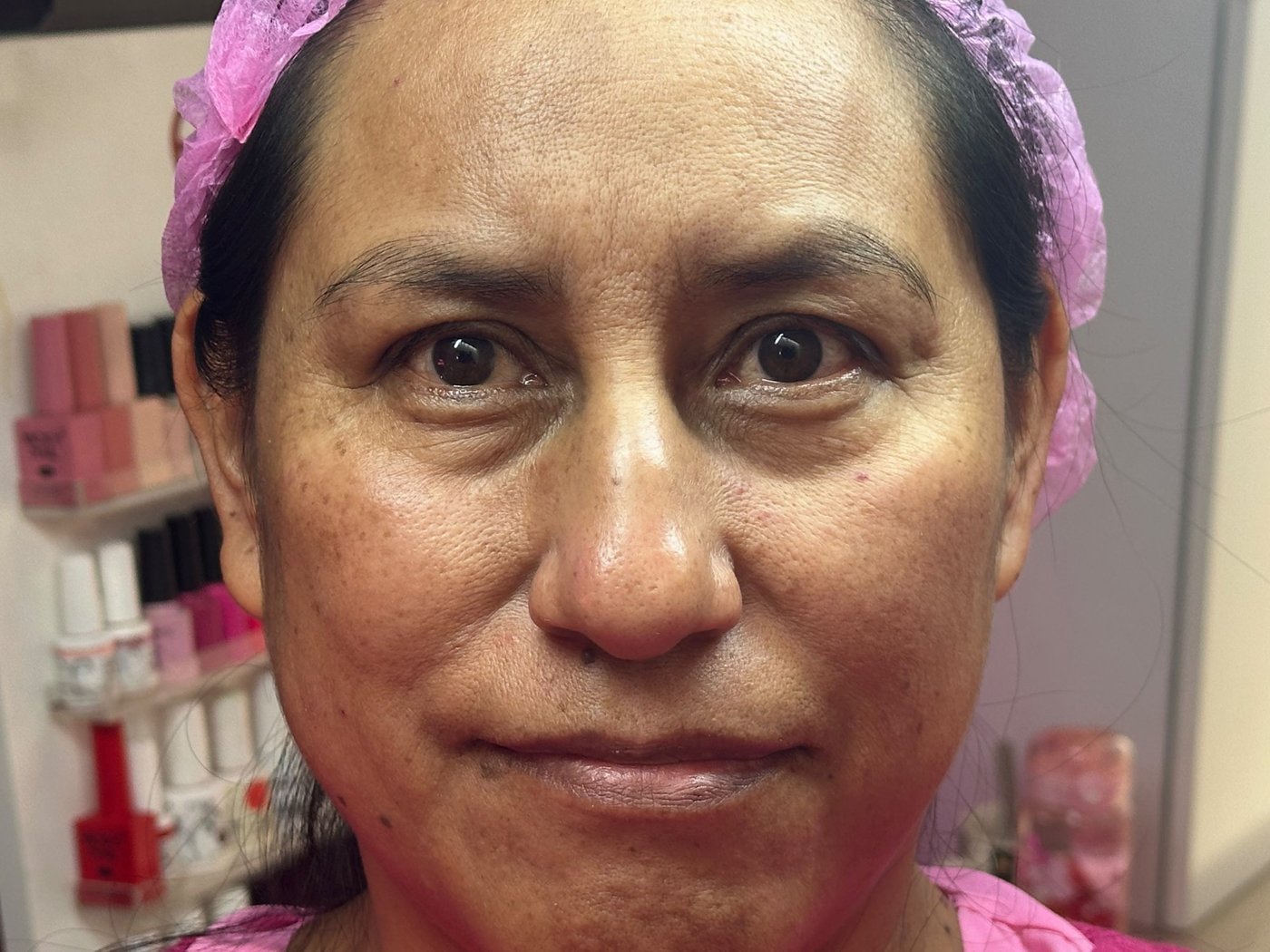 Antes